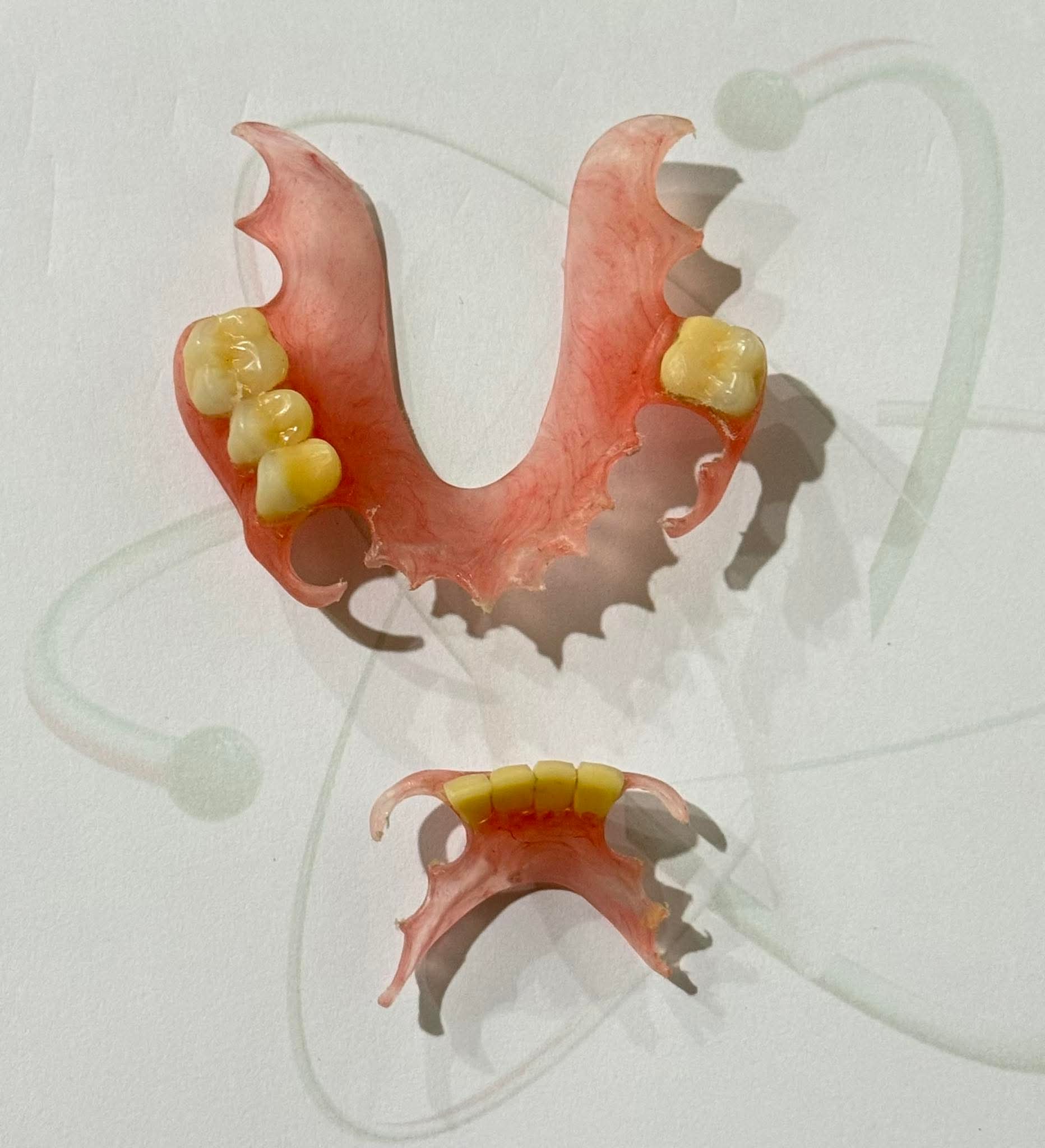 Denture (Removable teeth for elderly, per tooth)